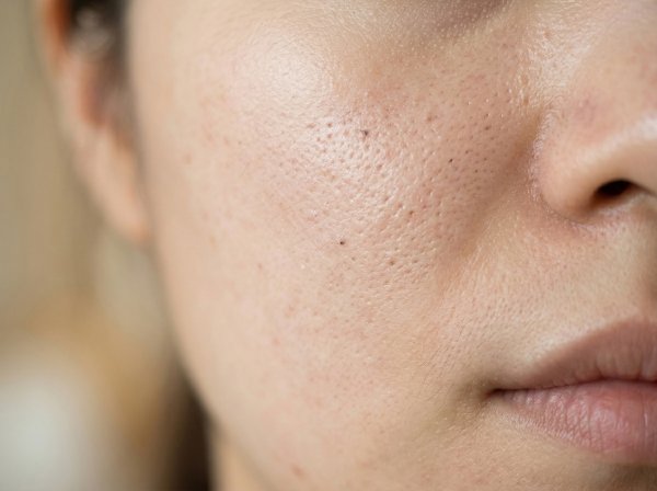 HOMEBOX20260414142400_eef7