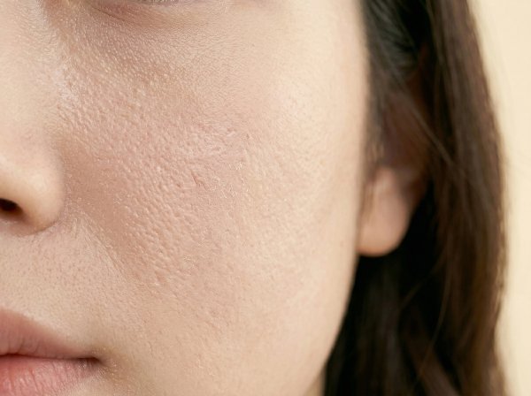 HOMEBOX20260414142510_007c